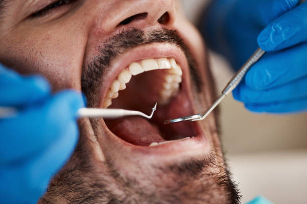 Best Emergency Dental Care for Sports Injuries in Choccolocco, AL