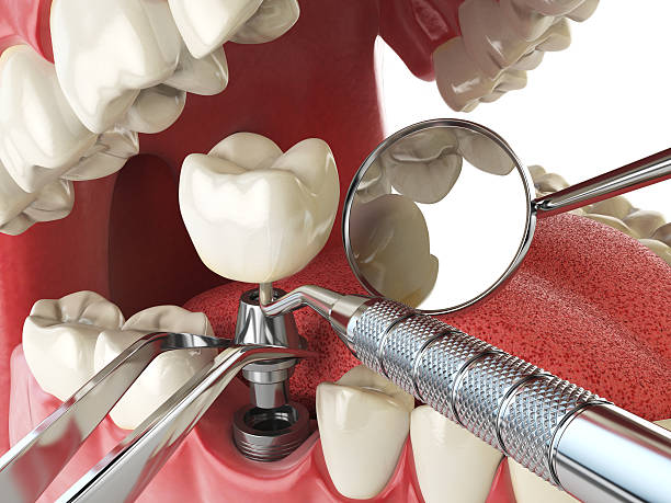 Best Emergency Treatment for Oral Infections in Choccolocco, AL